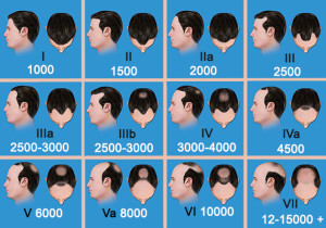 Exoderm Medical Centers Artificial Hair implant scales 